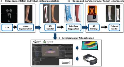 Augmented Reality to Assist Skin Paddle Harvesting in Osteomyocutaneous Fibular Flap Reconstructive Surgery: A Pilot Evaluation on a 3D-Printed Leg Phantom